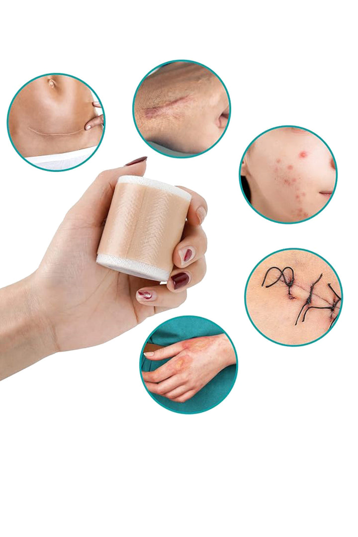 Inner Sense Silicon Scar Tape